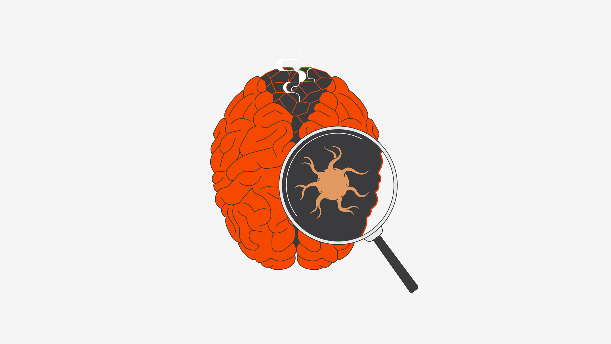 Illustration d’un cerveau enflammé et d’une loupe montrant des microglies dans le cerveau