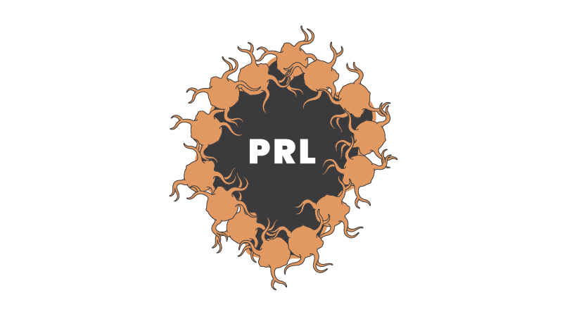Illustration showing iron-laden microglia surrounding the lesion edge of paramagnetic rim lesions