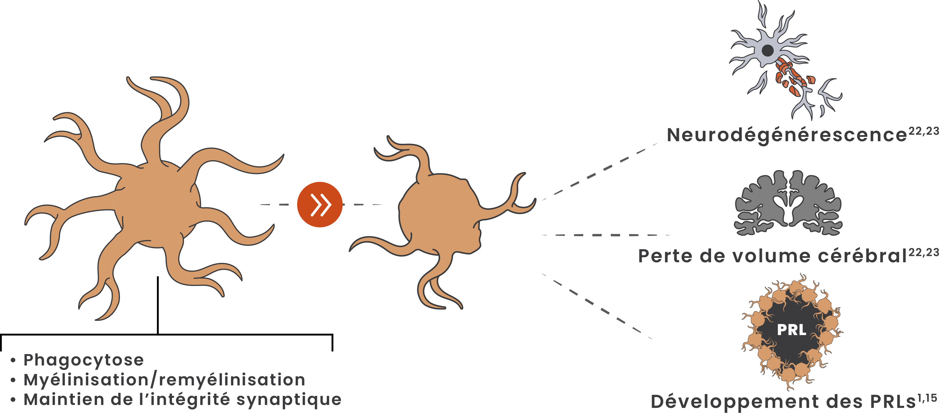 Illustration montrant la microglie passant d’un état homéostatique à un état associé à la maladie
