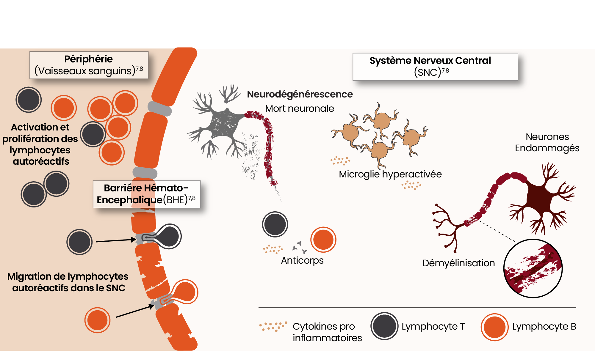 Illustration montrant la pathophysiologie de la neuroinflammation aiguë et persistante